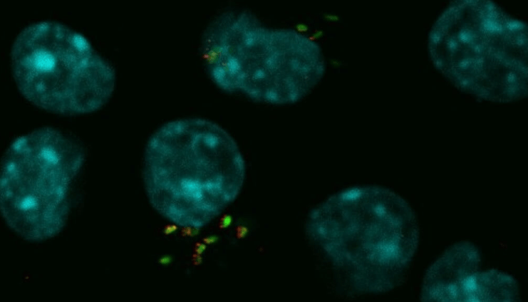 Un avance científico abre nuevas posibilidades para combatir la brucelosis&nbsp;bovina